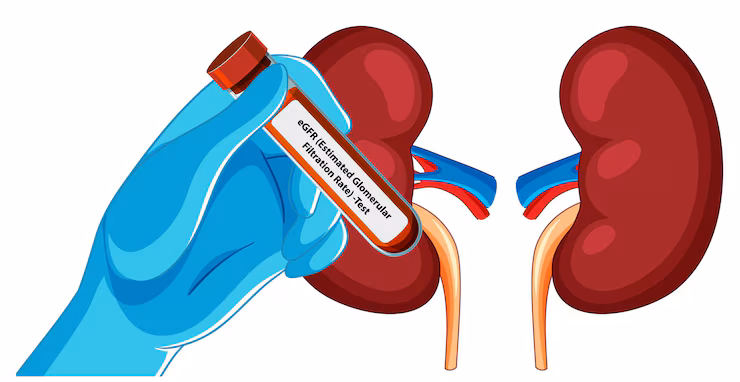 Acute & Chronic Kidney Failure